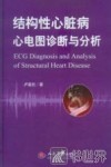 结构性心脏病心电图诊断与分析