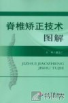 脊椎矫正技术图解