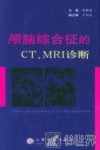 颅脑综合征的CT、MRI诊断