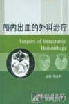 颅内出血的外科治疗